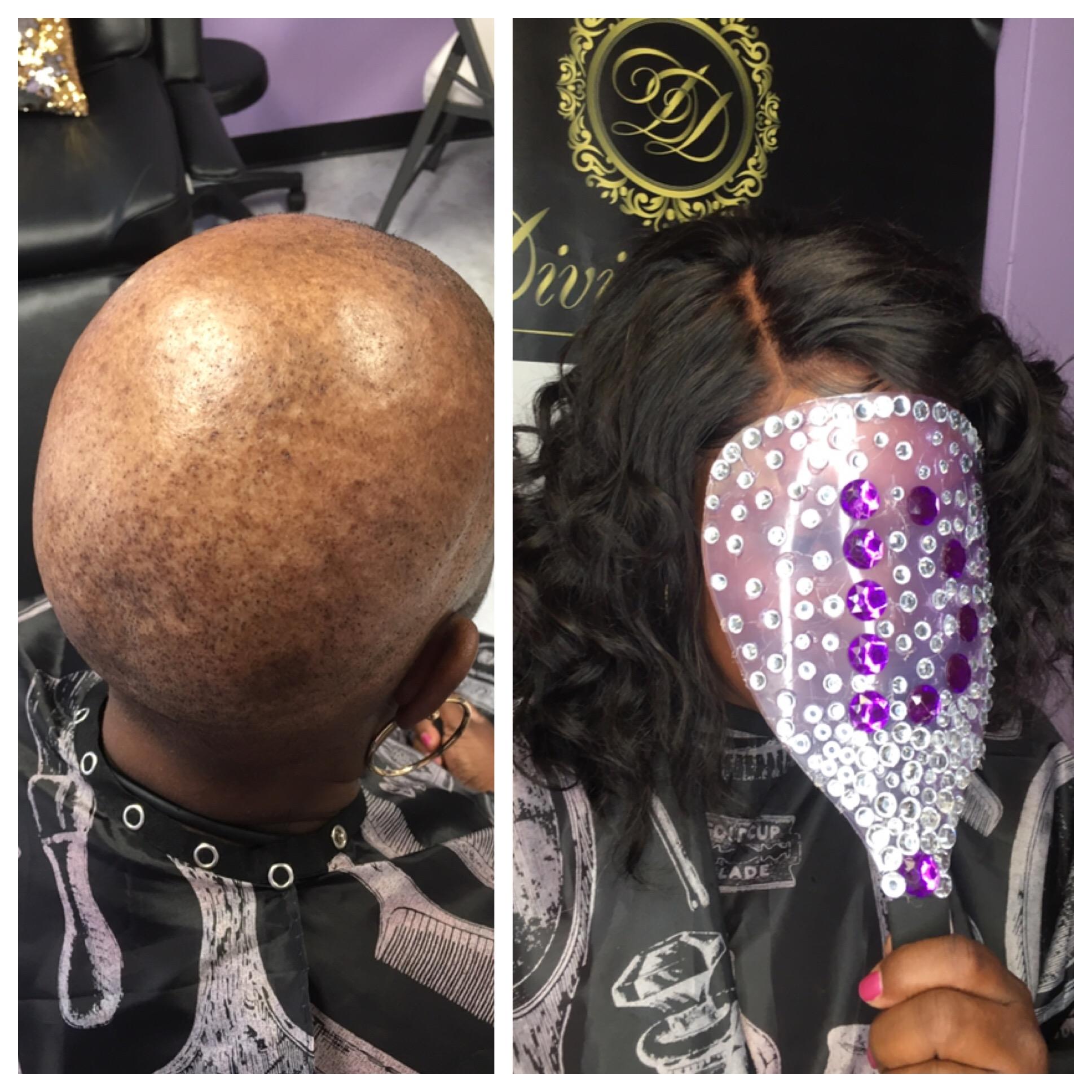 FREE Cranial Wig Prosthesis for Veterans with Alopecia/HairLoss