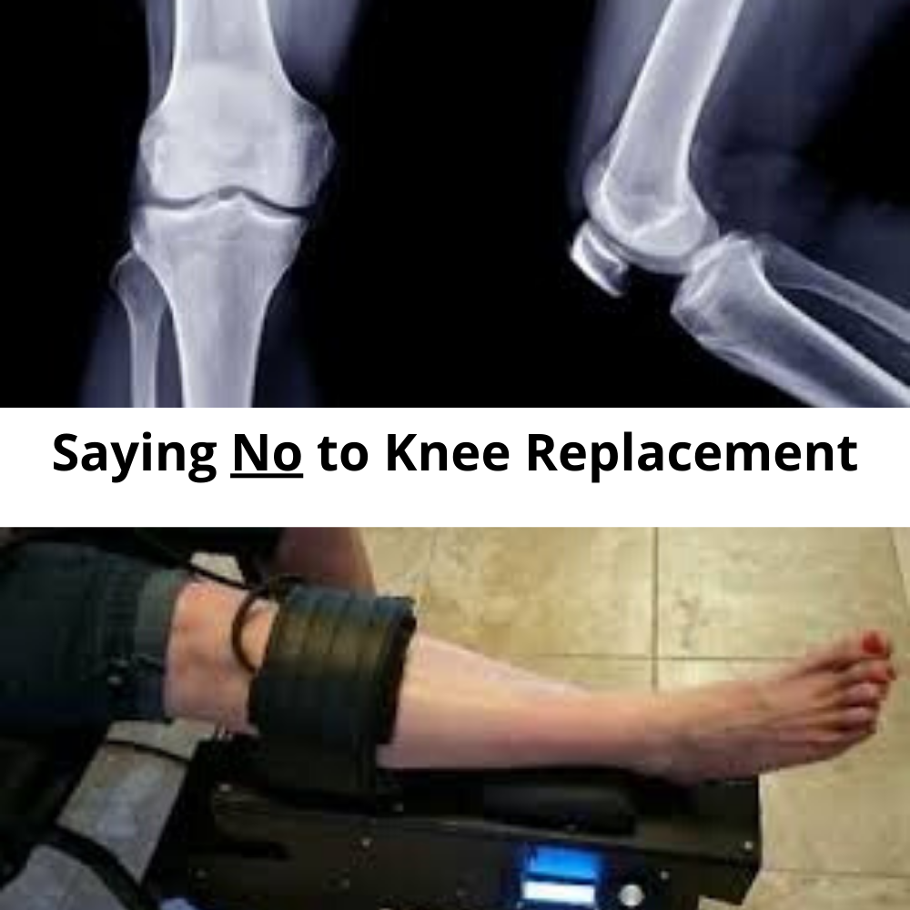 The Matrix Knee on Trac Solution to avoid knee surgery